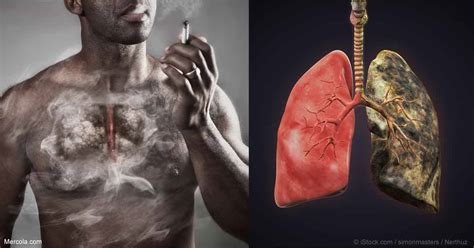 The Impact of Smoking on Physical Health